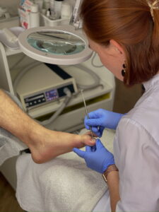Terapia wrastającego paznokcia 1 IMG 5656 jpg